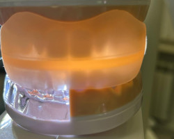 1 ЭТАП – Диагностика